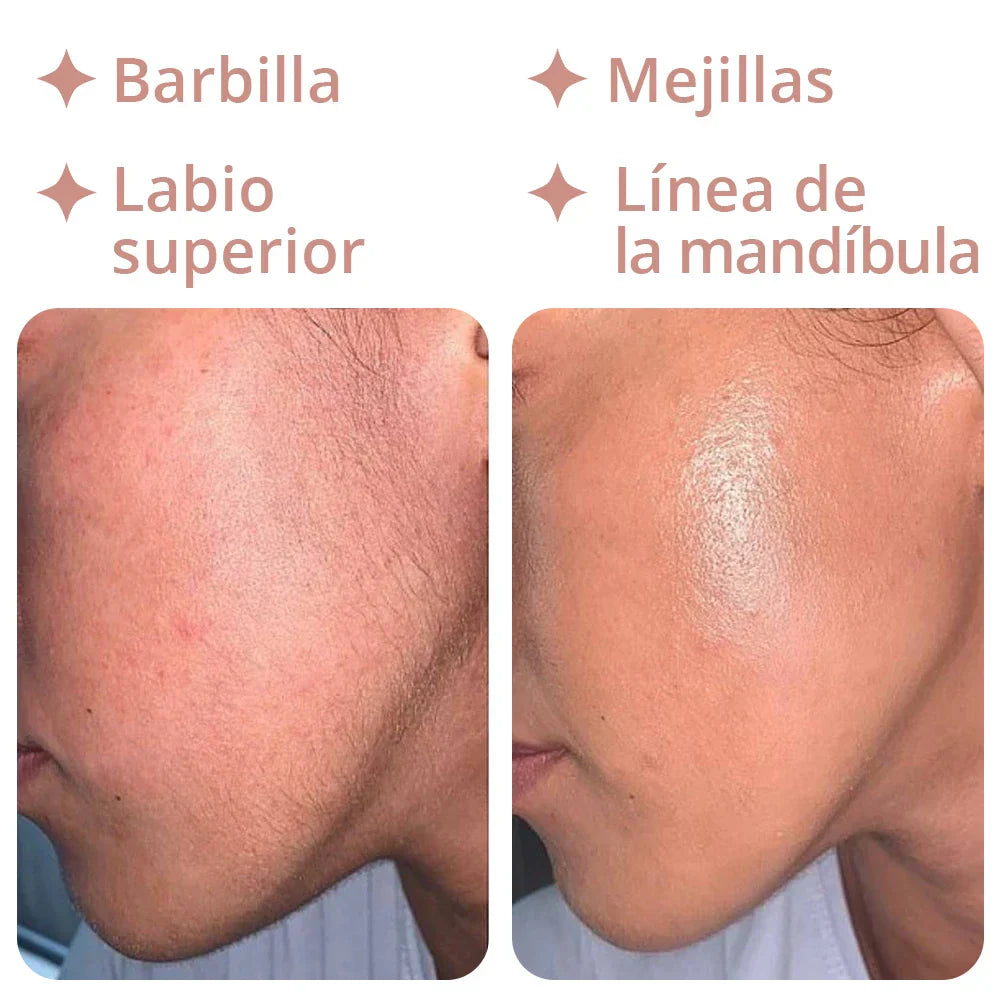 Depiladora 18K - Removedor de Vello Facial Pro